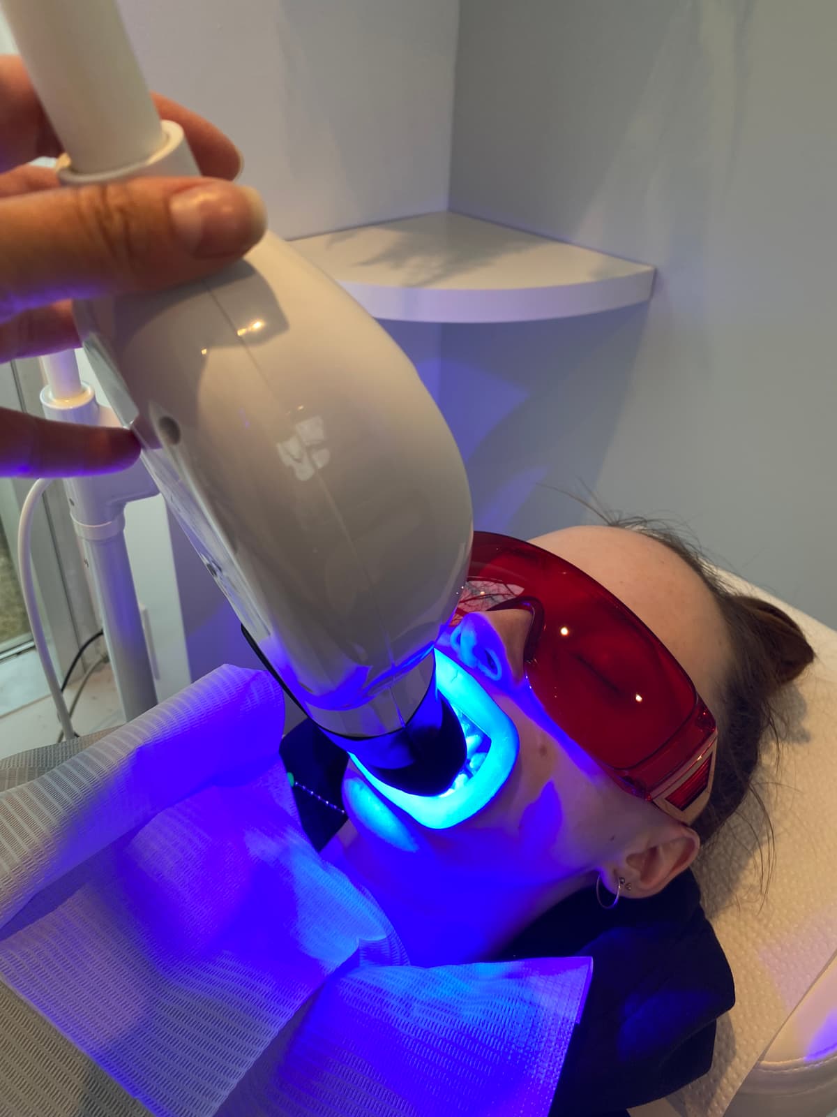 Teeth whitening before and after result - Client 3